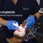 Single-Tooth-Implants-Explained