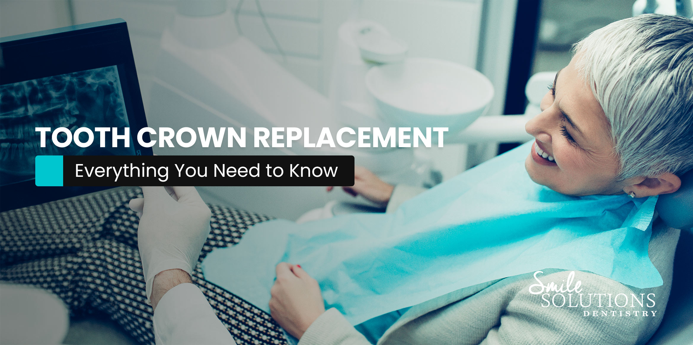 Everything You Need to Know About Tooth Crown Replacements